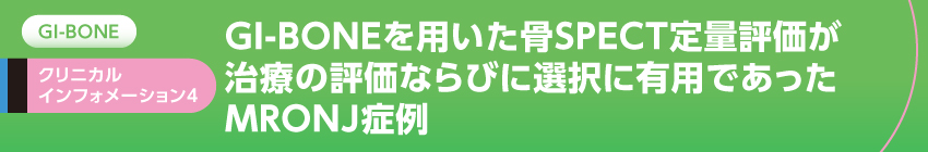 GI-BONEを用いた骨SPECT定量評価が治療の評価ならびに選択に有用であったMRONJ症例