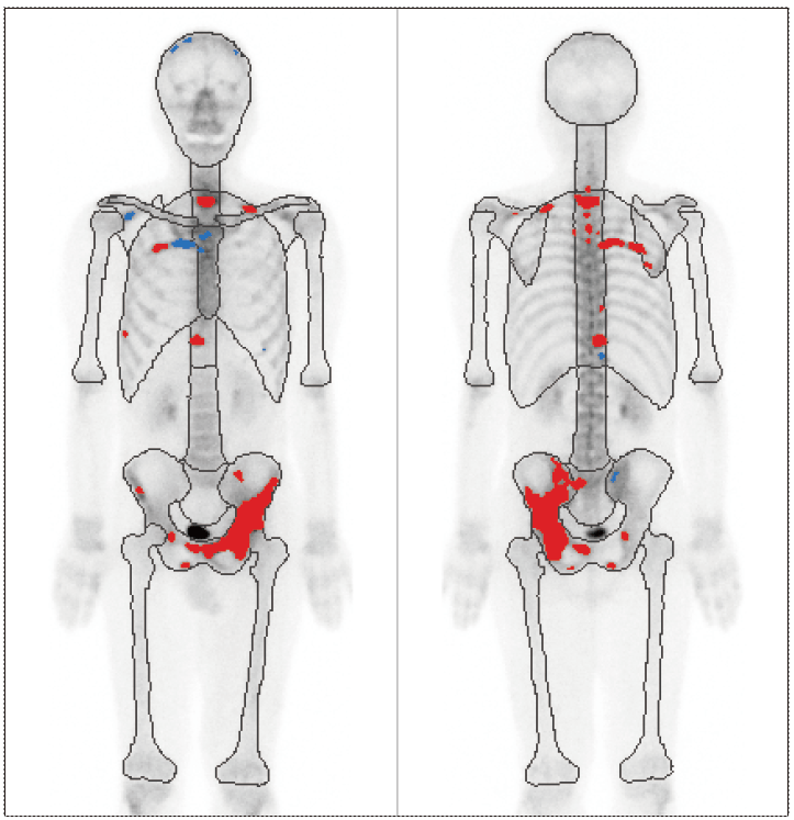 Clarity2D処理画像