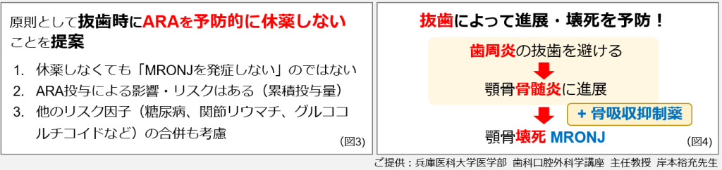 図3抜歯時にARAを予防的に休薬しない,図4抜歯によって進展・壊死を予防