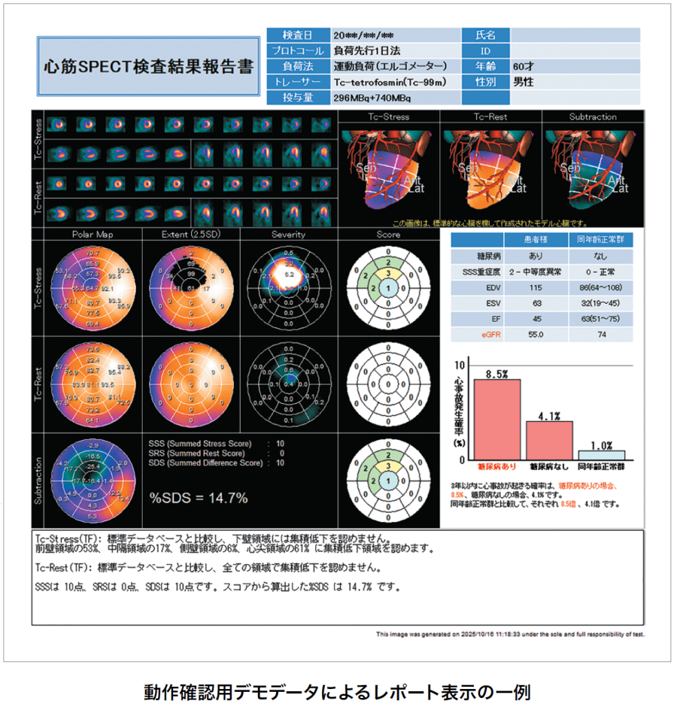 動作確認用デモデータによるレポート表示の一例