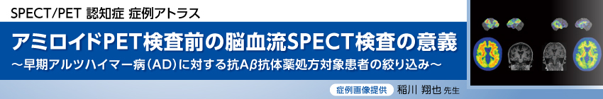 SPECT/PET 認知症 症例アトラス アミロイドPET検査前の脳血流SPECT検査の意義