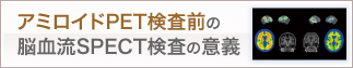 アミロイドPET検査前の脳血流SPECT検査の意義