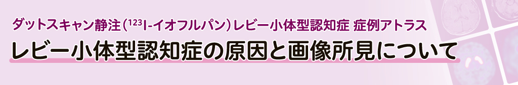 レビー小体型認知症の原因と画像所見について