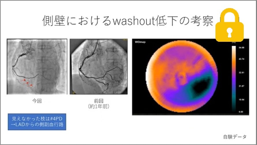 症例1　70代男性(主訴：労作時倦怠感)