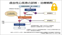 治療戦略における心筋シンチとFFRの役割