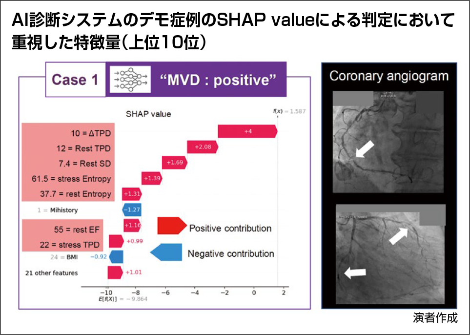 AI診断システムのデモ症例のSHARP valueによる判断において重視した特微量