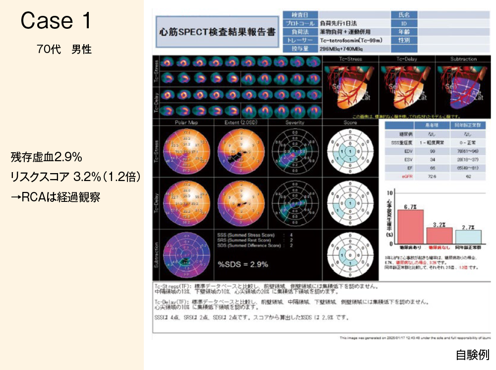 症例1 70代男性 残存虚血2.9% リスクスコア3.2% RCAは経過観察