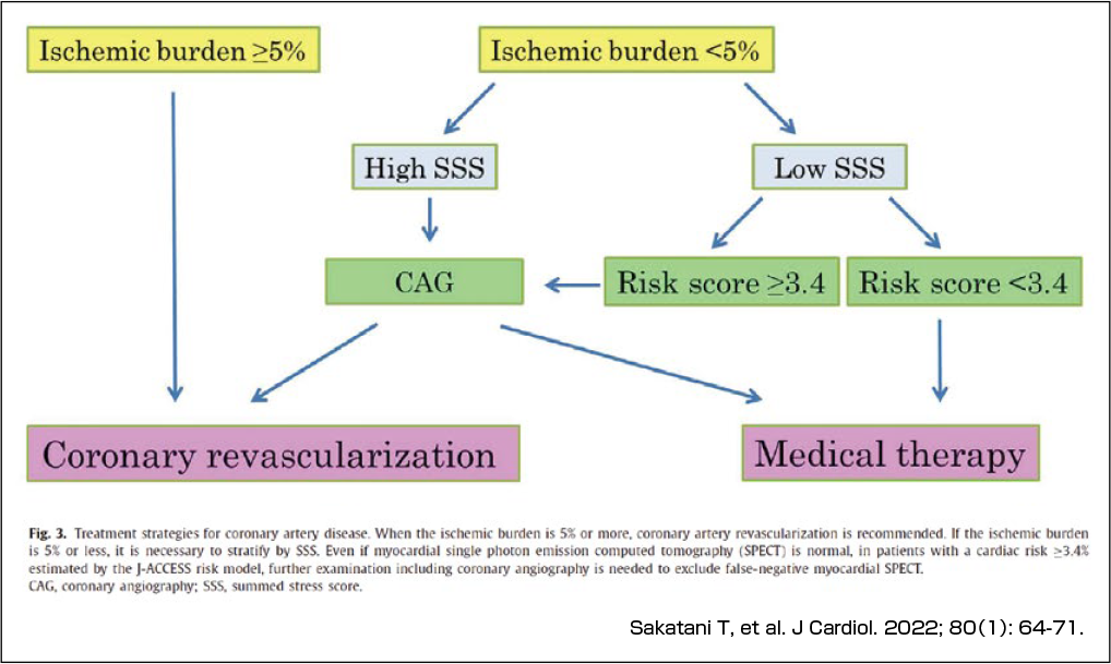 虚血性心疾患の治療方針