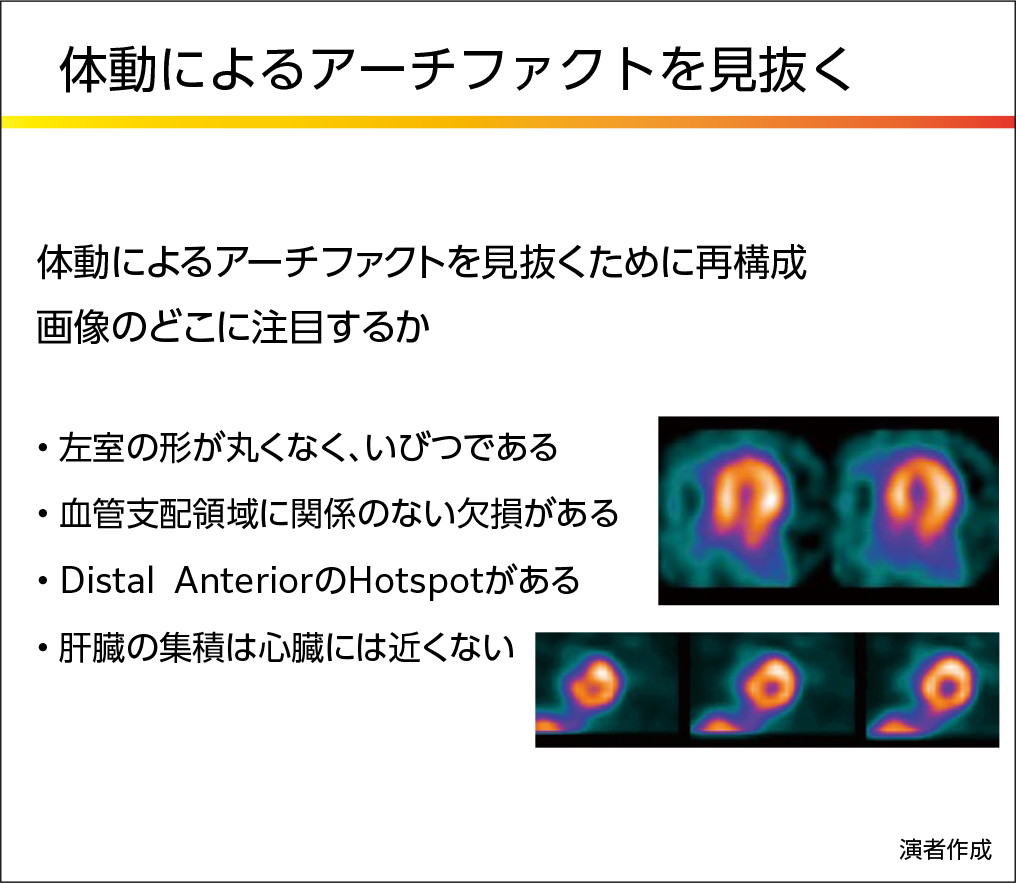 体動によるアーチファクトを見抜くには再構成画像のどこに注目するか