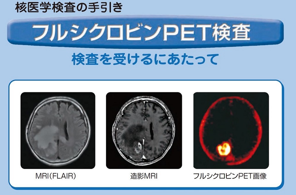 フルシクロビンPET検査　検査を受けるにあたって