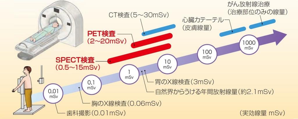 放射線の影響の図