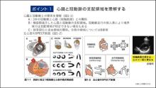 読影の基礎１ サムネイル